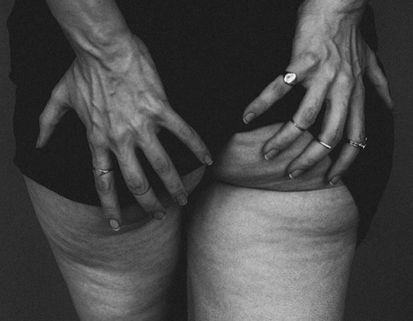 #ómegrun2018
Endurskilgreindu "galla" þína. Slit geta til dæmis verið merki um þroska og styrk.