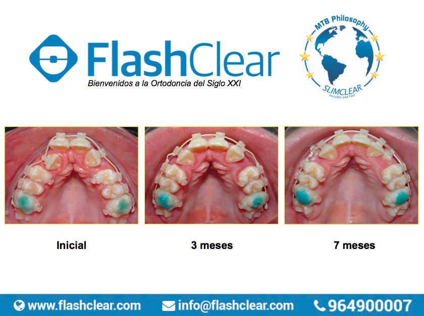 FlashClearSys tweet picture