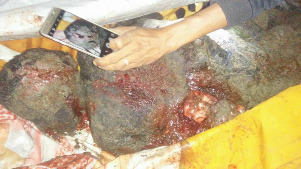 wafaahmed1234's tweet photo. #Fishermen_Massacre_in_AlKhuba 
9/1/2018
#AlHudaydah: The American Saudi warplanes committed a massacre targeting fishermen in ​​AlKhuba, killed 5 and injured others ...

#Yemen
#Saudi_Led_Coalition
#SaudiArabia
#UnitedNations
#DecisiveStorm
#UNICEF
#HumanRights
#Trump https://t.co/Wl7JBDYAUo