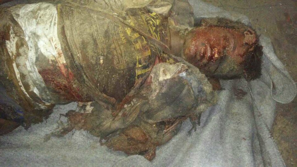 wafaahmed1234's tweet photo. #Fishermen_Massacre_in_AlKhuba 
9/1/2018
#AlHudaydah: The American Saudi warplanes committed a massacre targeting fishermen in ​​AlKhuba, killed 5 and injured others ...

#Yemen
#Saudi_Led_Coalition
#SaudiArabia
#UnitedNations
#DecisiveStorm
#UNICEF
#HumanRights
#Trump https://t.co/Wl7JBDYAUo