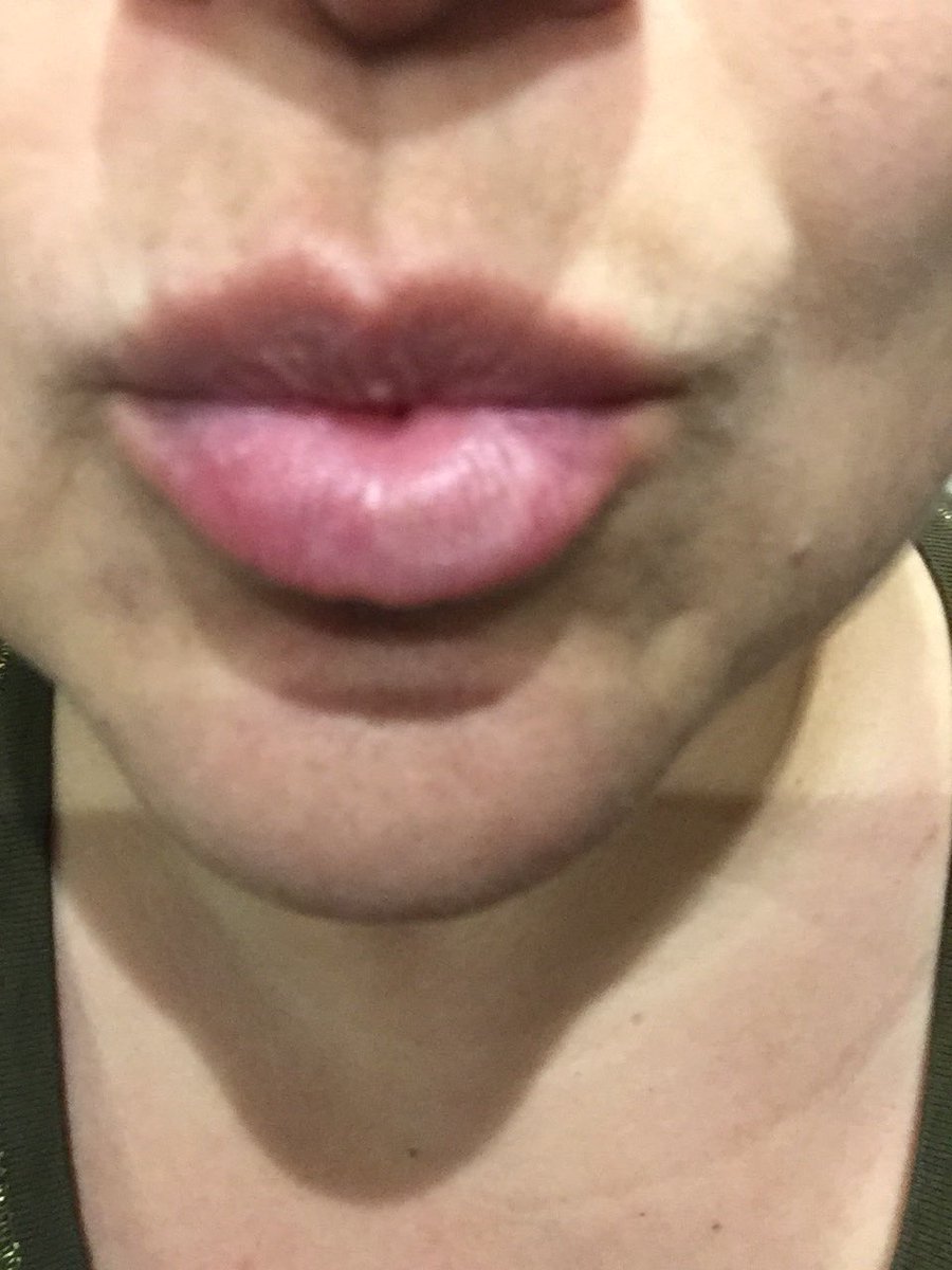 MyBitsandBleeps's tweet photo. My lips 👄 are much smoother now! Must be the therapeutic qualities of the Sea Buckthorn.  It’s found in my makeup bag. #montecho #natural #naturel #beauty #skincare #healing #seabuckthorn #healthyskin #naturalskincare #beautiful #crueltyfree #ecofriendly @montecho @M2brands #ad https://t.co/2uegoPHxV2