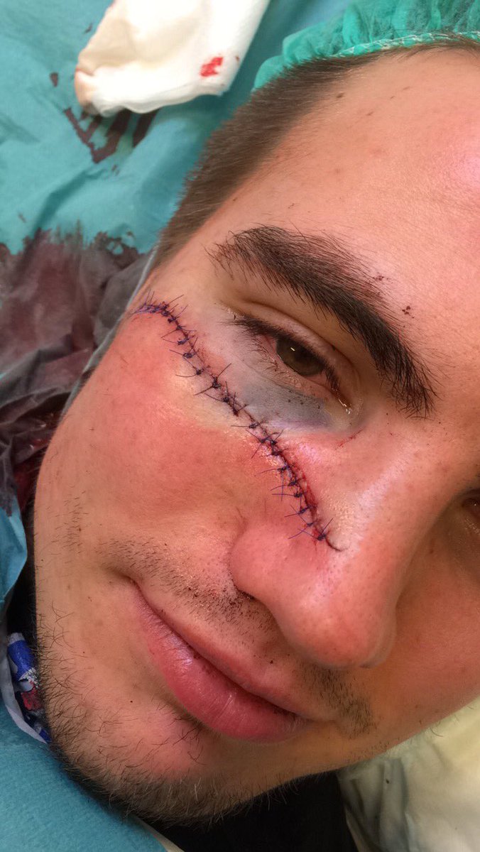 Simon Främgård tweet media