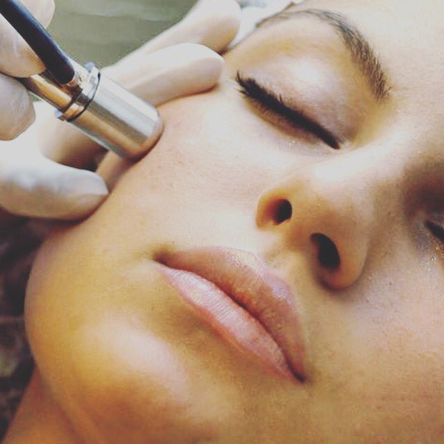 stephcrystalspa's tweet photo. Microdermabrasion is a quick and painless treatment that accelerates the rate at which dead skin is exfoliated, and jump-starts the proliferation of new skin cells. Book your series with me today for your best skin ever!! 770.993.0058 https://t.co/lGPcuTjIwq #avedaskincare https://t.co/Pfv03R64Xs