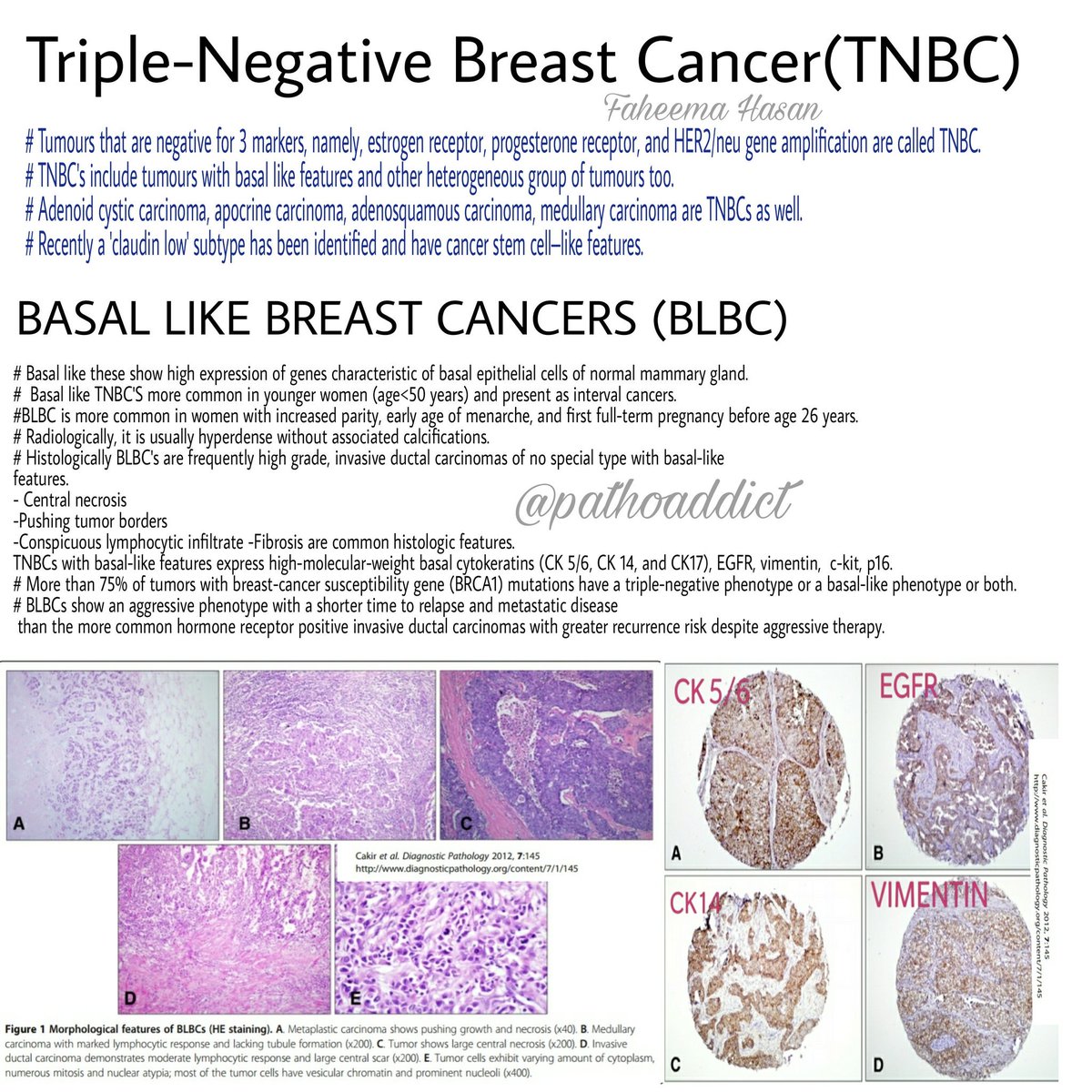 Faheema Hasan Md Characteristics Of Triple Negative Breast Cancers Pathology Breastpath Pathboards Pembeoltulu Kriyer68 Suraksharaob Binxu16 Appy Vashi Geronimojrlapac Smlungpathguy Vijaypatho T Co Pxbvs754se