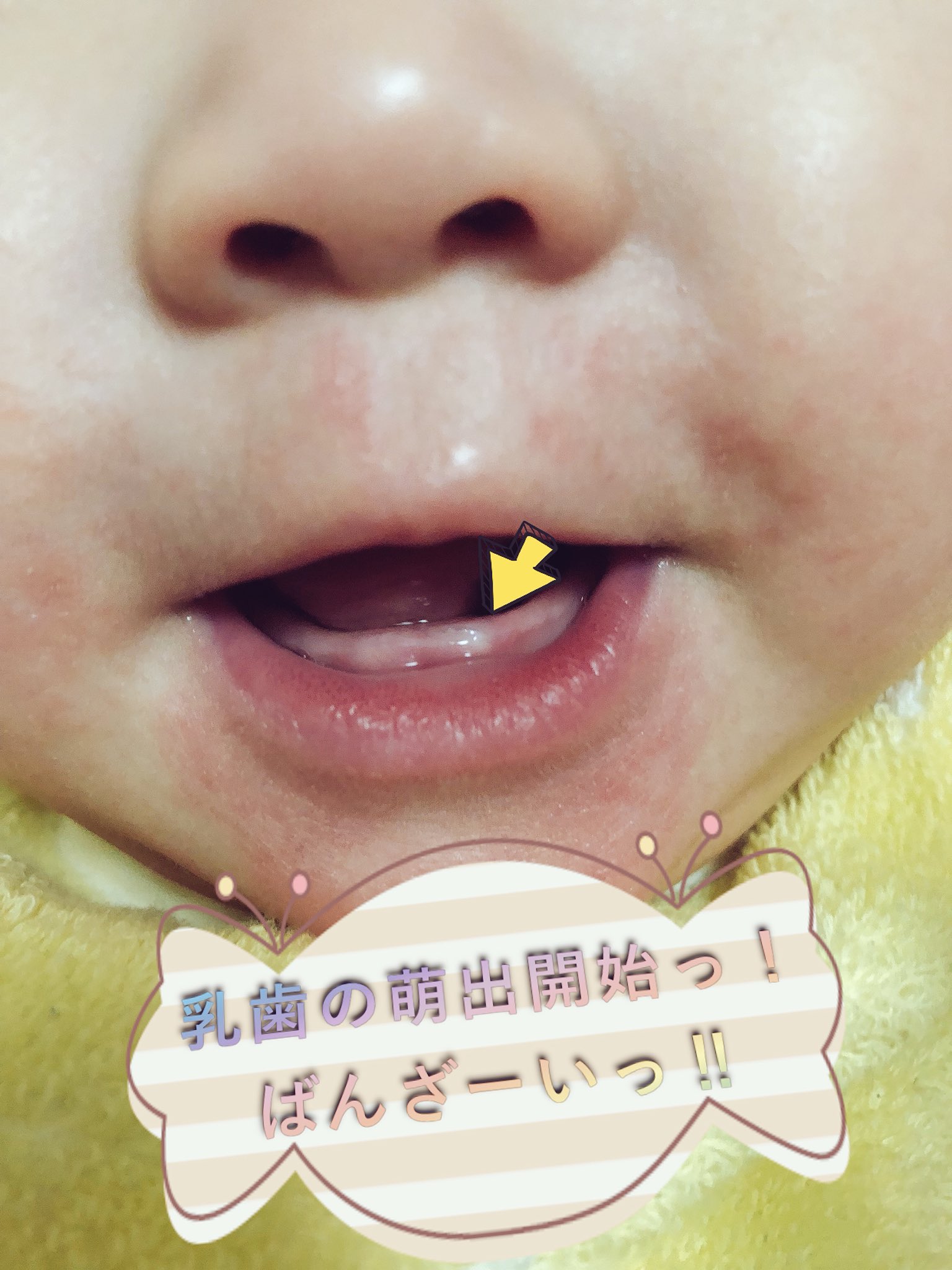 赤ちゃんの歯 Twitter Search Twitter