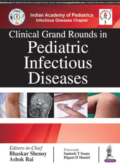 #ShopNow @ meripustak.com/pid-149489
Clinical Grand Rounds in Pediatric Infectious Diseases 
#ClinicalGrandRounds in #PediatricInfectiousDiseases #FreeShipping #MedicalStudents #MedicalExamsBooks #MBBS #Doctors #Surgery #Nursing #Clinical #Medicine #Online #Bookstore in #India