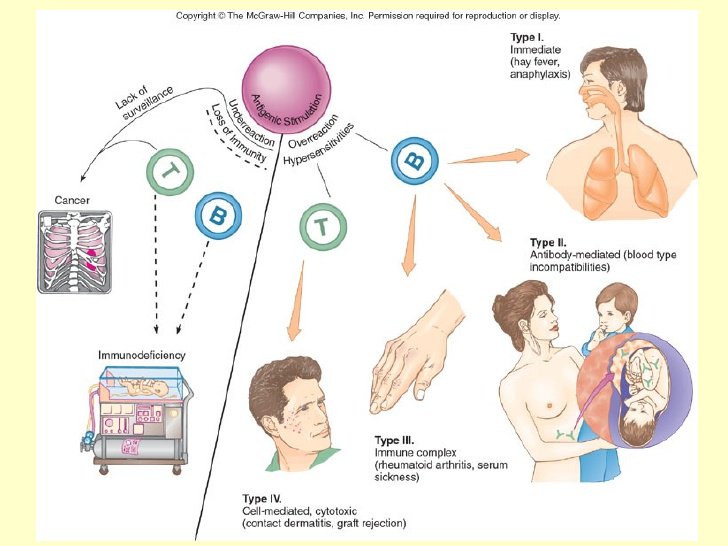 ClinicalPathol's tweet photo. #Immunopathology deals with immune responses associated with disease.And  includes the study of the pathology of an organism, organ system, or disease with respect to the immune system, immunity, and #immuneresponses. https://t.co/eldf1N1rdg