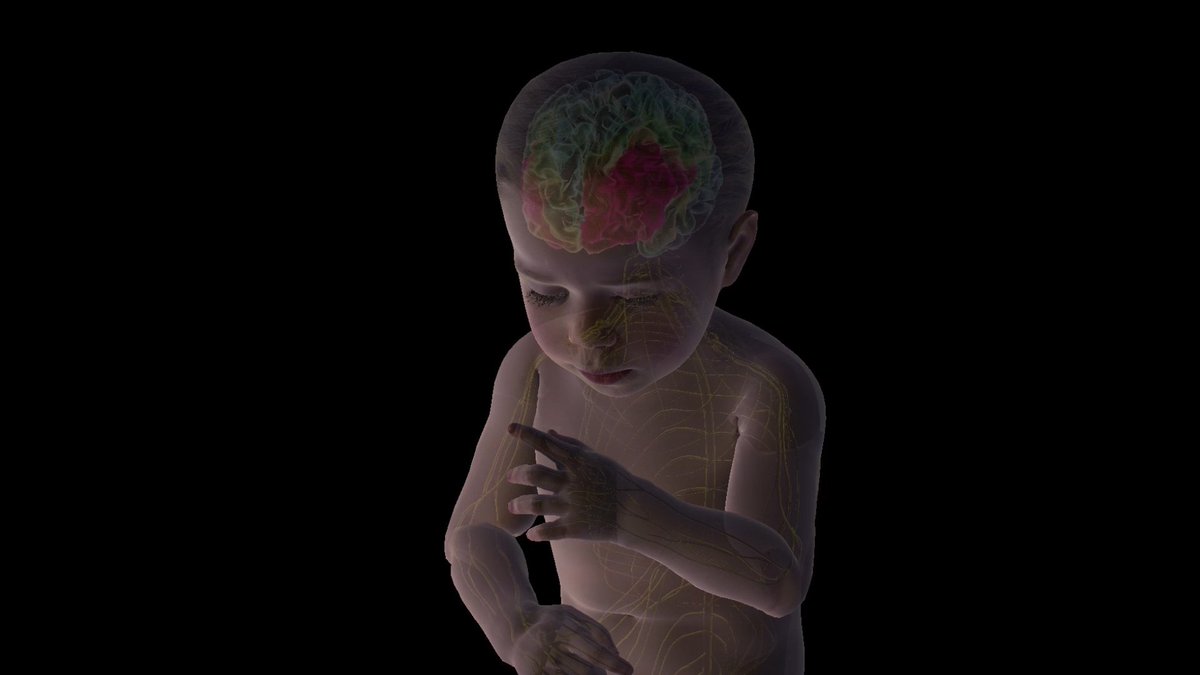 Soulmachines's tweet image. BabyX 5 is the first human #machine brought to life with a #virtual nervous system and digital DNA. #DigitalDisruption