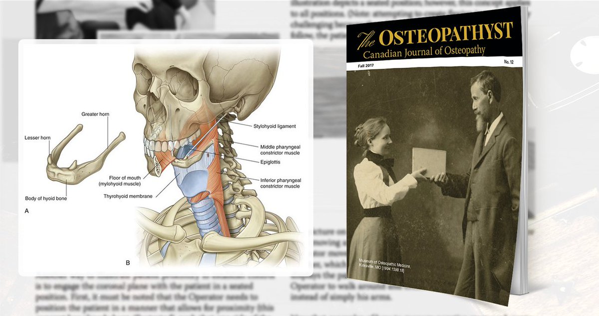 Osteopathyst's tweet photo. There are four infrahyoid muscles. However, for this article’s purposes we will mention only two: the sternothyroid and sternohyoid.

Read Cervical Spine Motion and The Hyoid Connection By Lee Jarvis in Issue 12 on Page 5: https://t.co/Fq5d7Yy8Ah #Osteopathyst https://t.co/1r9fec6MHl