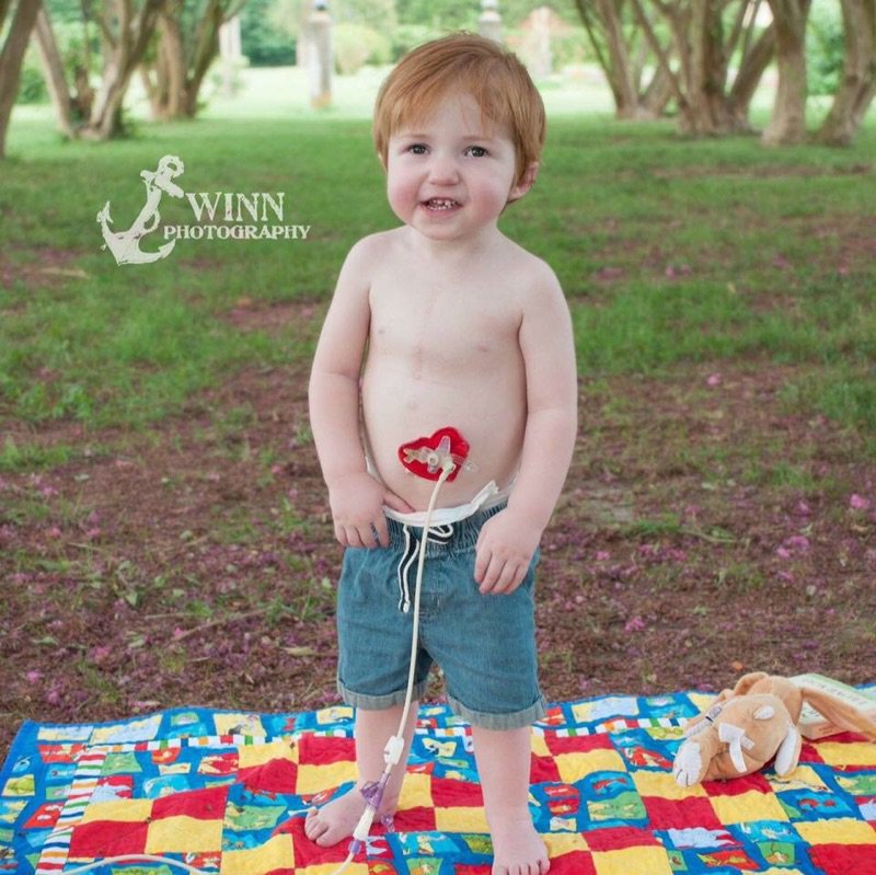 JennVoix's tweet photo. @WorthwhileWeds This is my nephew Oliver.
This precious 2 year old kid has already had 2 Open Heart Surgeries & 6 Heart Caths. Thank goodness for GREAT hospitals for kids!
#CHDawareness #OliverTheGreat #TetralogyOfFallot #22q11 #PulmonaryAtresia #MAPCAs
#TeamOliBear https://t.co/vFfPatjjtt
