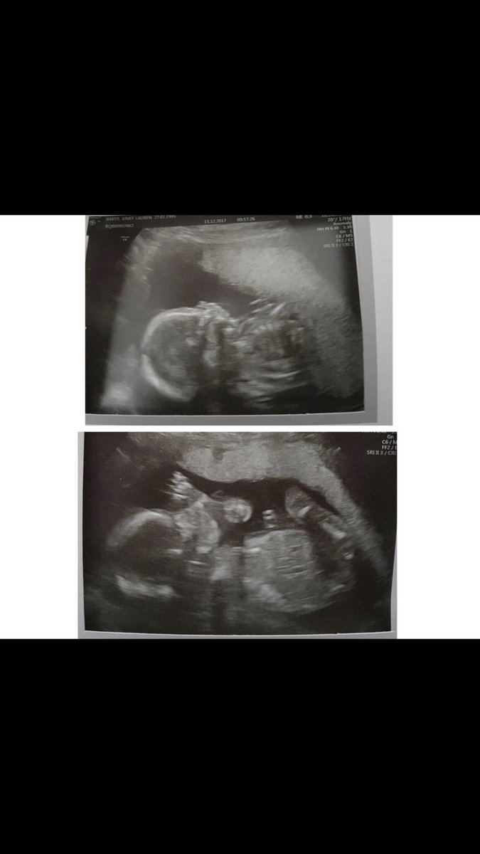 PerryMaye's tweet photo. Sooner she’s here the better! 🎀💗 https://t.co/dQ0mJxUBJx