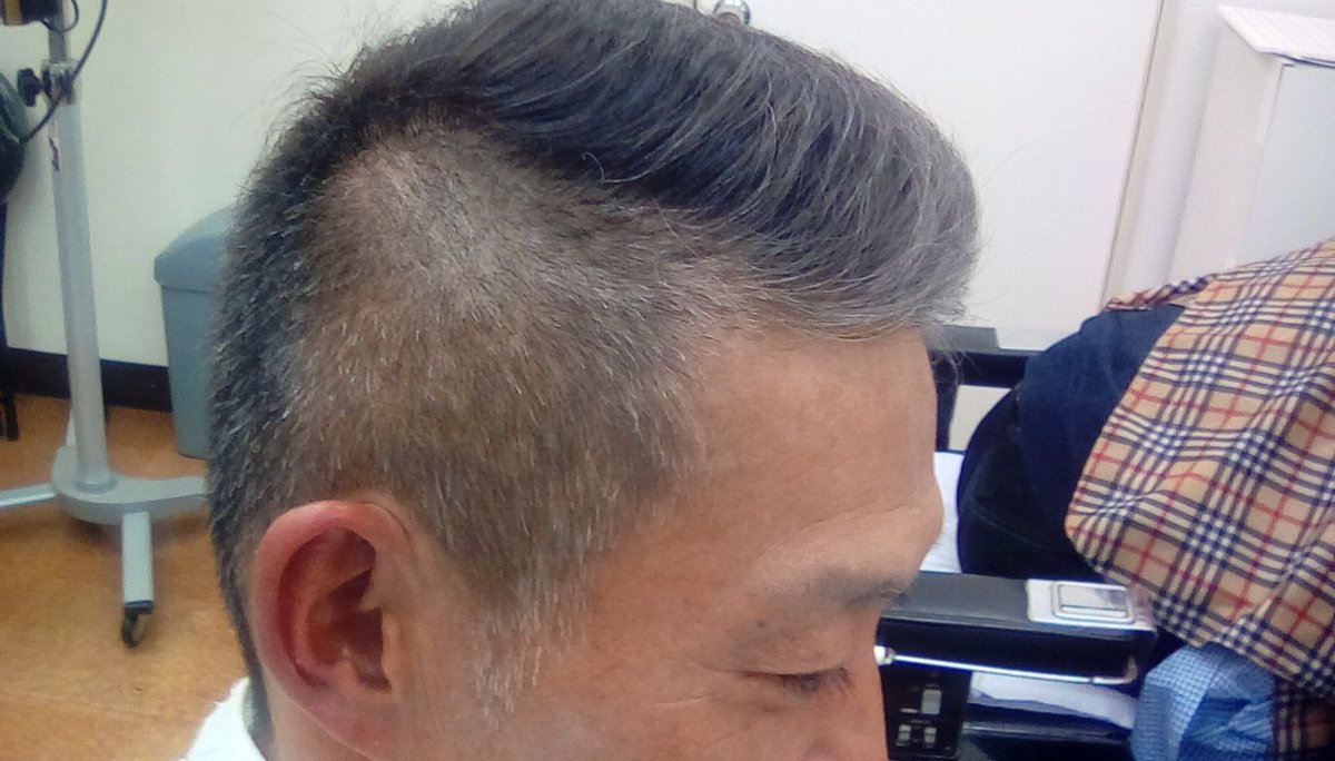 サン理容 短髪縮毛 パンチ アイロン アイパー 求人も 成人式への震災刈り シルバーワックス仕上げ サン理容 短髪縮毛 パンチ アイロン アイパー 求人も 成人式への震災刈り シルバーワックス仕上げ
