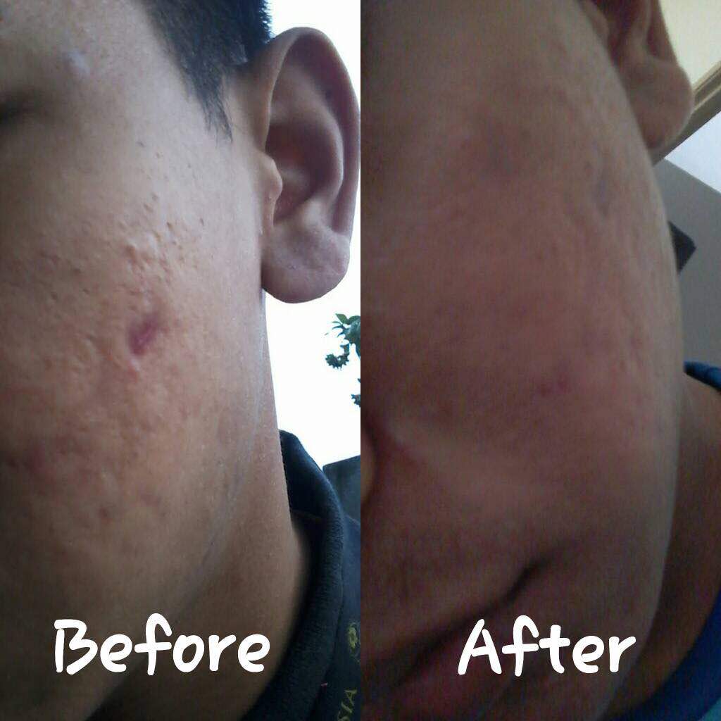 profixforever's tweet photo. Meyh wasap sis utk grab harga promo #profix . HIGHLY RECOMMENDED UTK UOLLSSS YG ADA PROBLEM KULIT !

https://t.co/VXYQMwXtKP https://t.co/hFpavx790c