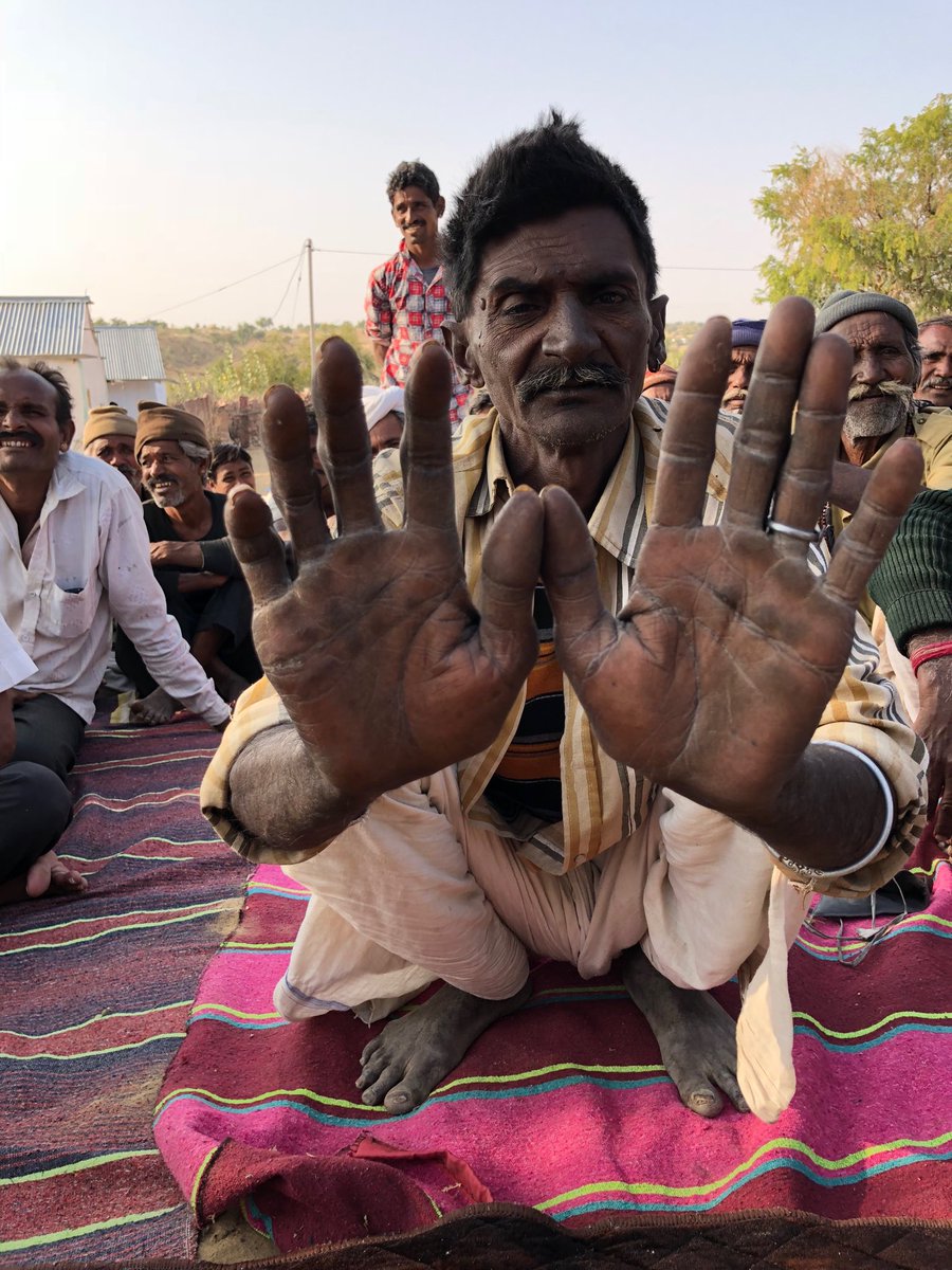 In a village today I met a man who said he was unable to use his Aadhaar card because the biometrics did not recognise his fingertips worn away by hard work.