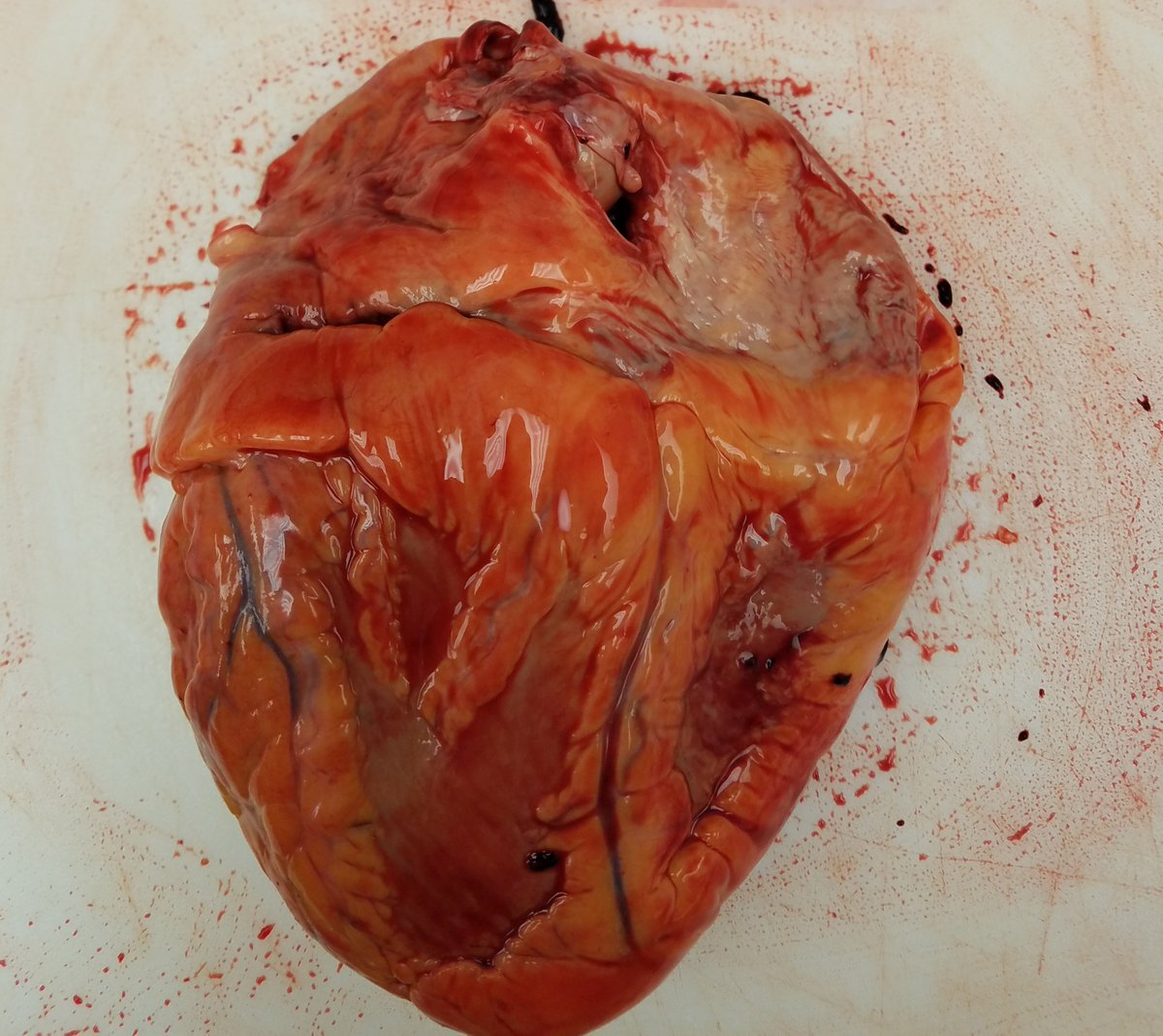 Live stream a fascinating evening with us tonight @ 7:30 CT.  #TheAutopsyTalks Topic:  The heart <a href="/MCLChicago/">MCL Chicago</a> Join the curious. #MultimediaDiscussion Here's your 1/2 off code:  ATHALF mclchicago.com/the-autopsy-ta…