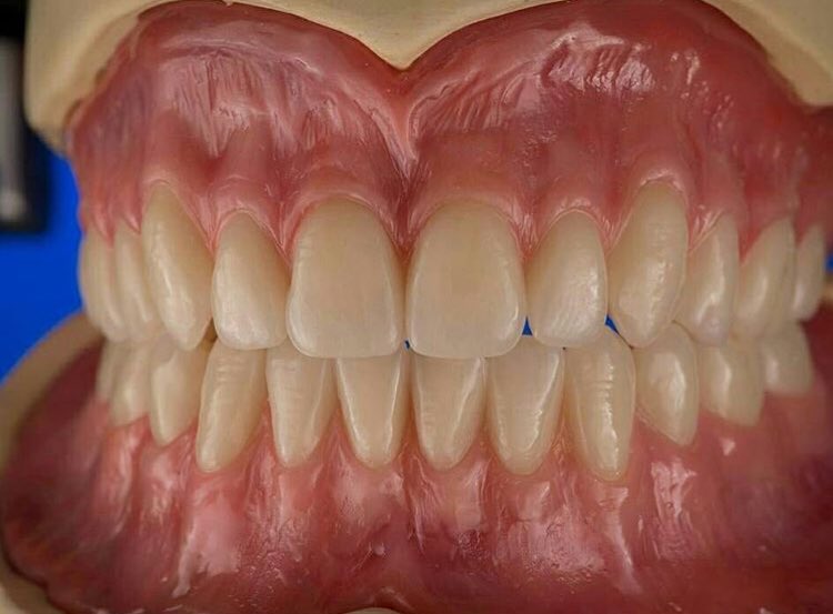 36SağlıkBranşı AtamaBekliyor SESİMİZİ DUYABİLEN DEVLET BÜYÜKLERİNEDİR TWİTLERİMİZ <a href="/Dr_Demircan/">Dr Ahmet Demircan</a> <a href="/saglikbakanligi/">T.C. Sağlık Bakanlığı</a> @RT_Erdogan <a href="/BA_Yildirim/">Binali Yıldırım İletişim Ofisi</a> #DişProtez1500AtamaBekliyor