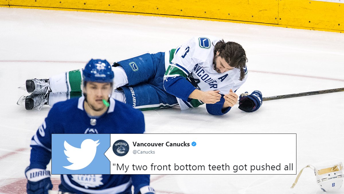 BarDown's tweet photo. The details of Chris Tanev’s injury after being hit in the face with a puck are gruesome: https://t.co/R6H60nWkPY https://t.co/GWYUSyNtxj