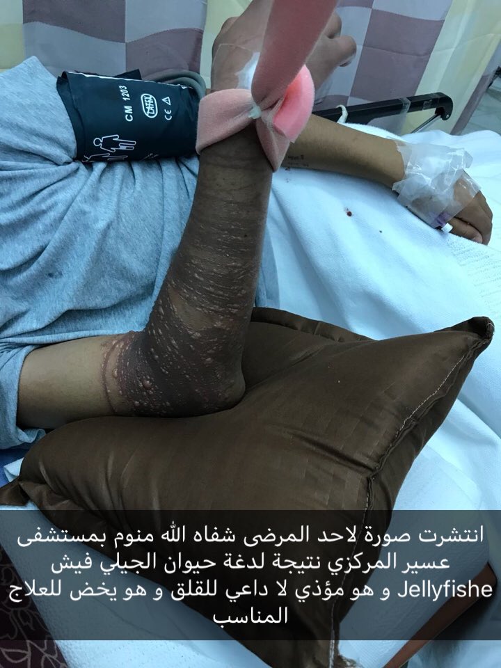 dr_dhafez's tweet photo. #بحر_المعجز https://t.co/jc2y77woph