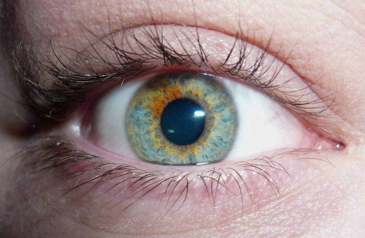 Глаза человека меняют цвет. Центральная гетерохромия хамелеон. Гетерохромия Радужки глаз. Центральная гетерохромия карих глаз. Центральная гетерохромия зрачок.