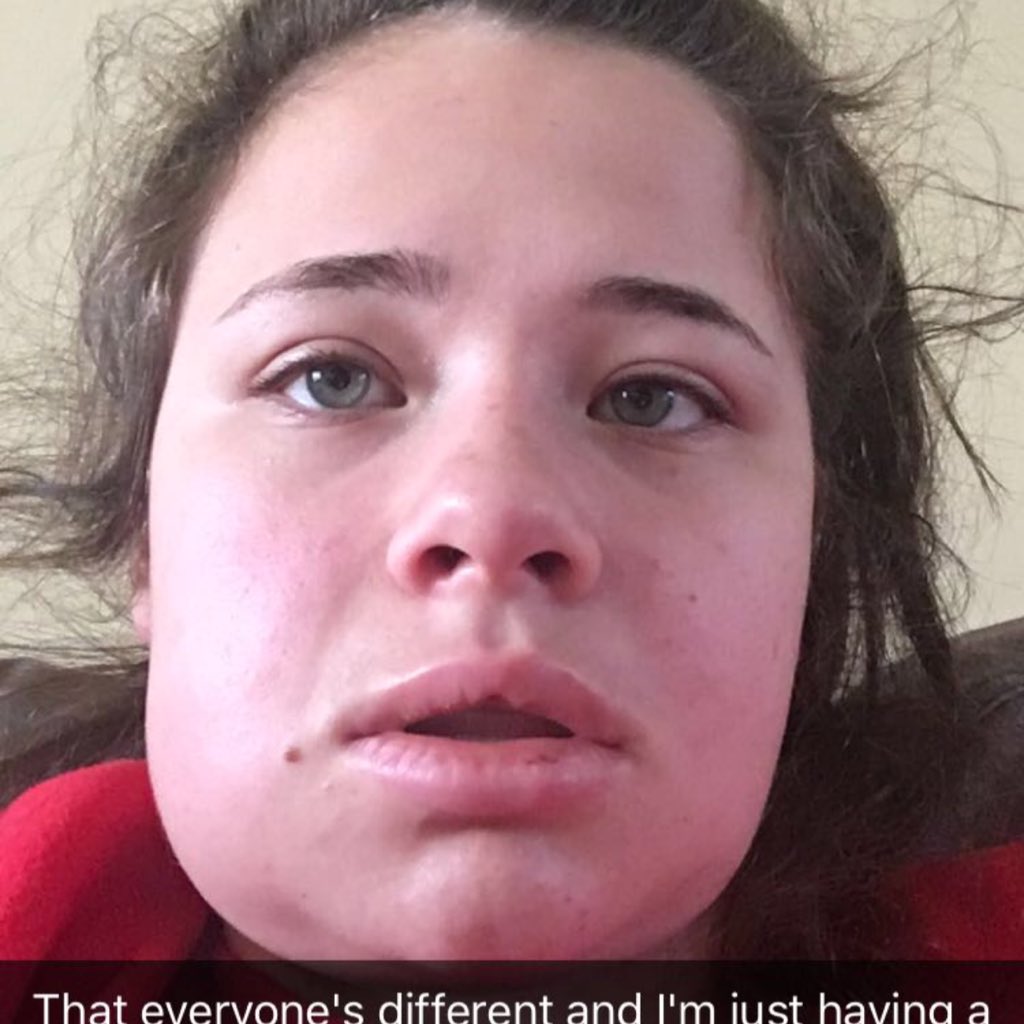 elisewhitty's tweet photo. #NewProfilePic #notasnapchatfilter https://t.co/HpWIe0zkII