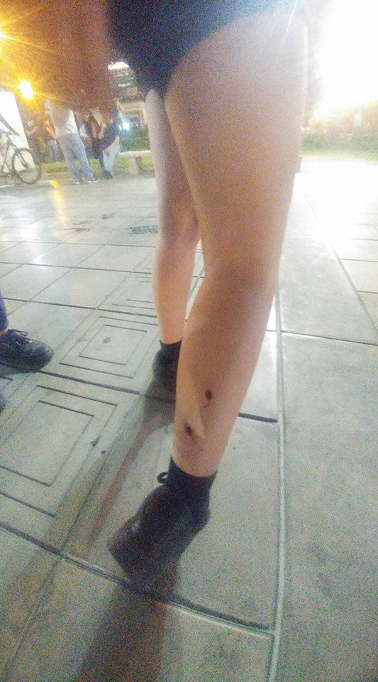PeruRebelde's tweet photo. ★ H O Y | E S | D Í A | D E | M A R C H A ★
Policía reprime con perdigones.

#AbajoElIndulto #FueraPPK #11E #TomaLaCalle #Perú https://t.co/dgfLI7PToC