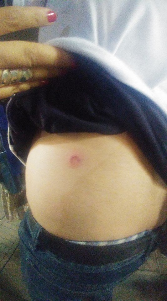 PeruRebelde's tweet photo. ★ H O Y | E S | D Í A | D E | M A R C H A ★
Policía reprime con perdigones.

#AbajoElIndulto #FueraPPK #11E #TomaLaCalle #Perú https://t.co/dgfLI7PToC