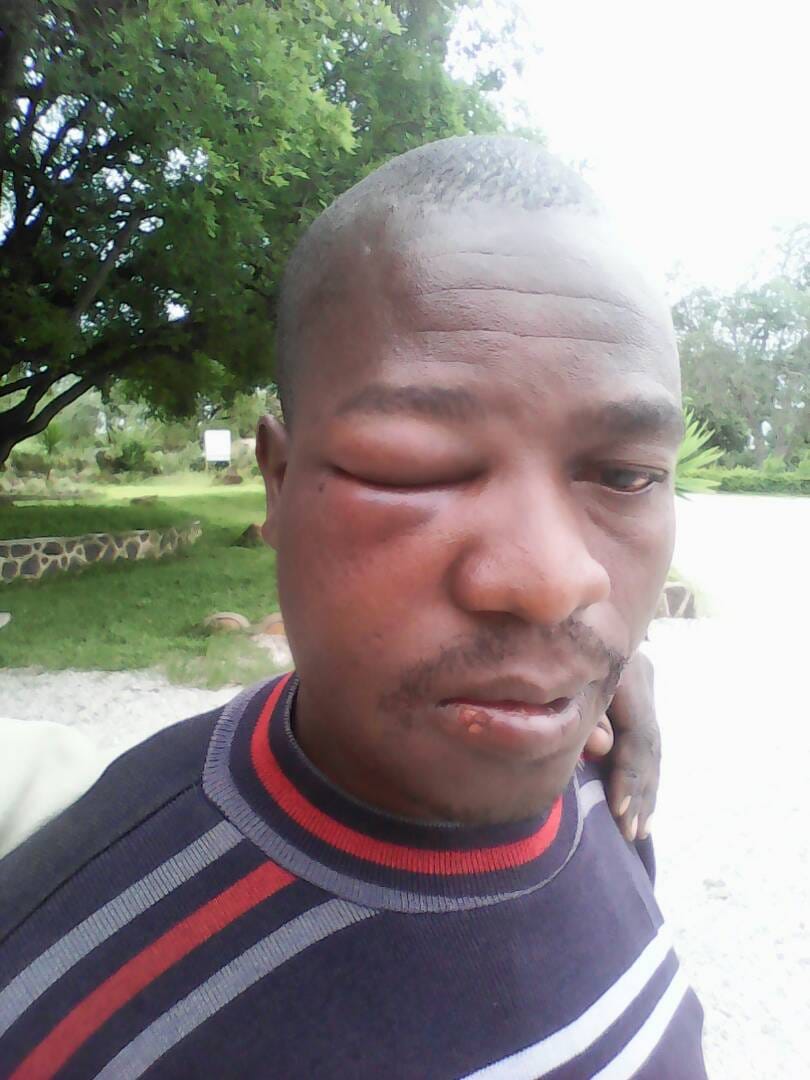 Heal Zimbabwe expresses concern over the upsurge in politically motivated violence.
healzimbabwetrust.org/?p=3027
@NPRCZim @CommMasunungure <a href="/rashidmahiya1/">rashid mahiya</a> <a href="/P_VanDamme_EU/">Philippe Van Damme 🇪🇺🇺🇦</a> <a href="/habakkuktrust/">HABAKKUK TRUST</a> <a href="/fortunechasi/">Fortune Chasi</a> @crisiscoalition <a href="/kubatana/">Kubatana</a> <a href="/yespeace2018/">Yes Peace</a> <a href="/HRWNORCAL/">Human Rights Watch</a> <a href="/ZimHRNGOForum/">Zimbabwe Human Rights NGO Forum</a> <a href="/zppinfo/">The Zimbabwe Peace Project</a>