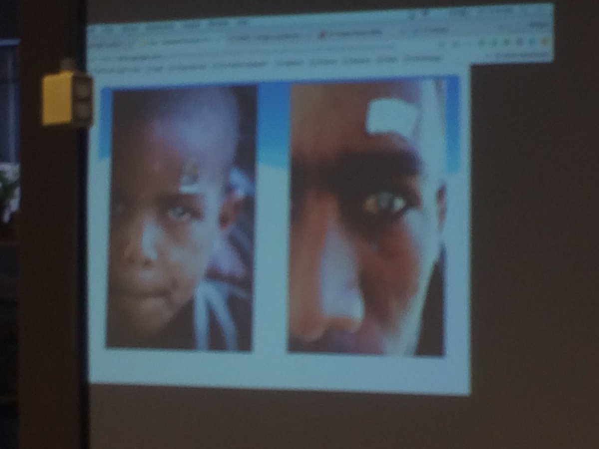 morgancuthbert's tweet photo. 7th graders learned about diseases and disorders of the eye. Dr. Cady shared his work with cataract disease and connection to the Himalayan Project. Learning about your body and empathy. Giving back! https://t.co/Py38fPa8PI #ConnectC2C @MAINETOY @YarmouthHMS https://t.co/U74vW4doIY