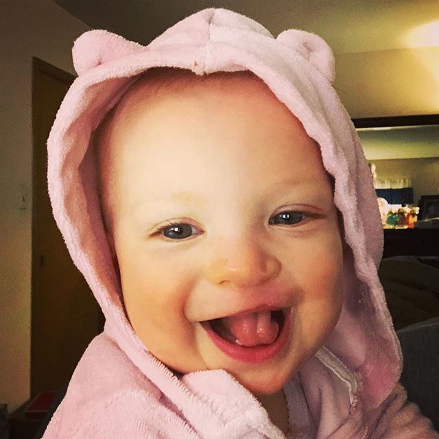 mhannaford's tweet photo. Seriously cannot believe this little amazing girl is 9 months old. That smile is incredible! #cleftpalate #cleftlip #cleftcutie #cleftstrong #lifeflip #agencylife #workfromhome https://t.co/3C8bXNEtiF