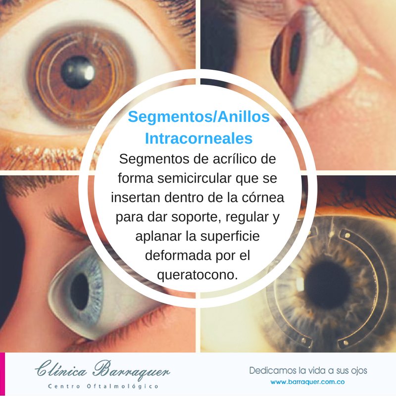 ClinicaBarraquer tweet media