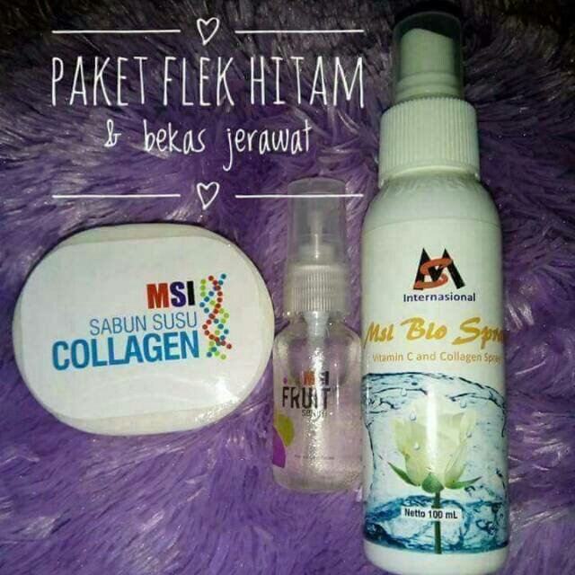 achies19's tweet photo. Saya menjual Paket Flek hitam &amp; bekas jerawat ala MSI seharga Rp250.000. Dapatkan produk ini hanya di Shopee! https://t.co/OR78IoY8Uu #ShopeeID https://t.co/pD72NLWx7j