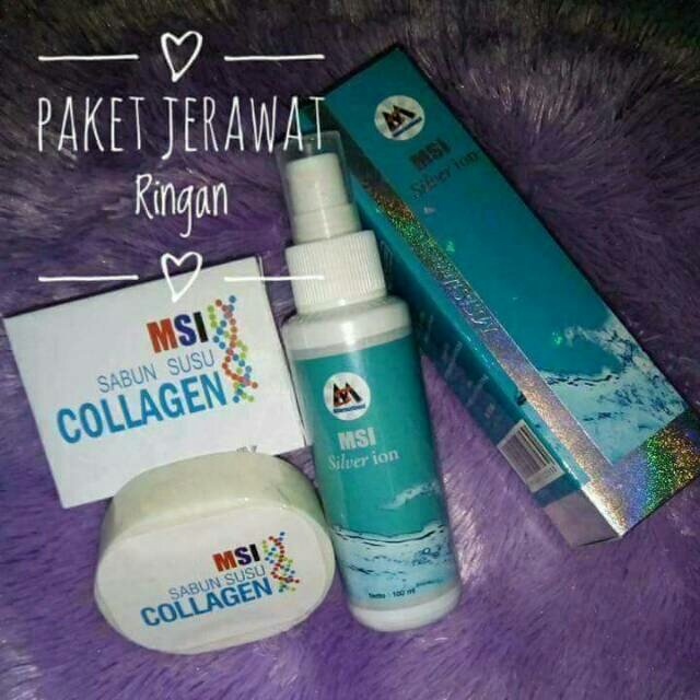 achies19's tweet photo. Saya menjual Paket Jerawat ringan ala MSI seharga Rp150.000. Dapatkan produk ini hanya di Shopee! https://t.co/swyeLsO3oY #ShopeeID https://t.co/8MhZ8Td4te