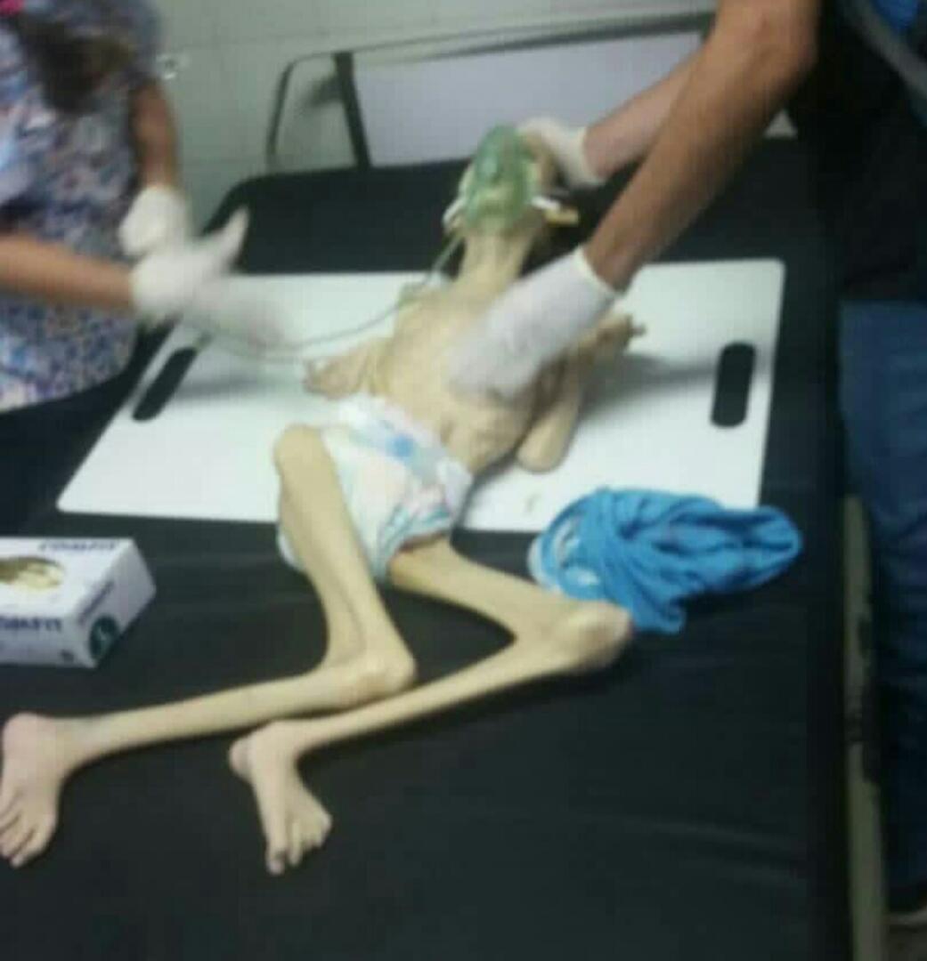 AnonimusCR's tweet photo. #12Ene
Estas fotos NO son del Holocausto Nazi, ni de Sudáfrica, ni de después de la Segunda Guerra Mudial . Ésta foto es actual, en Venezuela. una Sra con su hijo en Valencia Estado Carabobo, el niño murió por desnutrición, esto es inhumano. HAMBRUNA EN VZLA. https://t.co/2Mib38c2cM