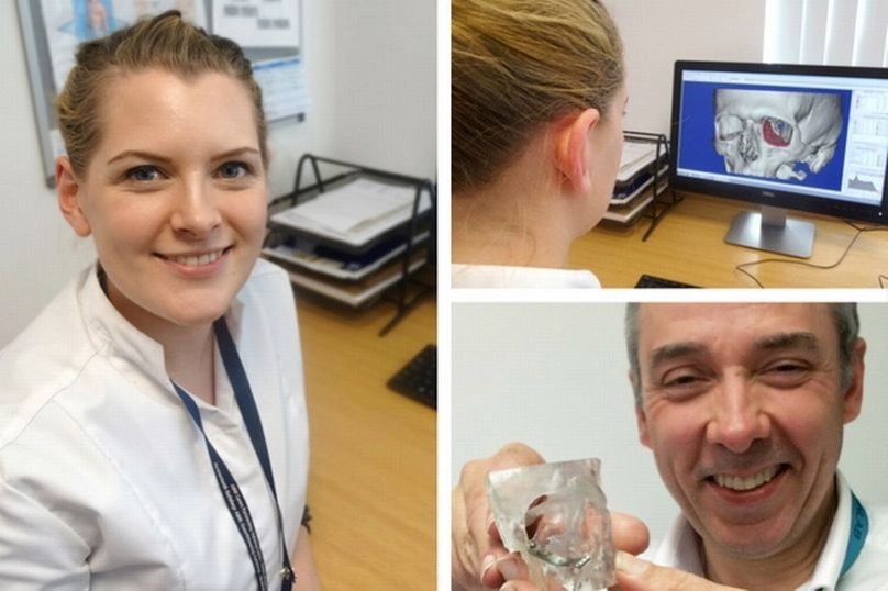 Rebuilding people’s faces by designing and 3D printing state of the art implants #Biohacking #tech4humans #technology #sustainability buff.ly/2mkjctk