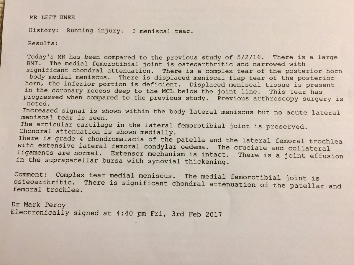 ElaZemp2's tweet photo. @mattbarbermd @KneeReplacement @neiltheknee @mykneeguide @TheKneePainGuru That’s maybe where all the problem started, I had stage 4 of OA... specially in patella https://t.co/SFqSWrirlu