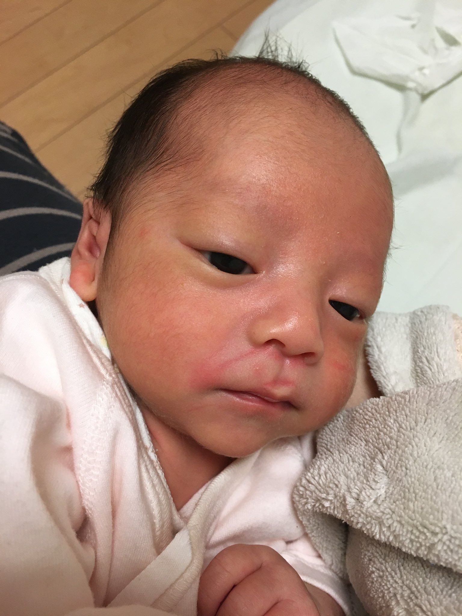 唯 ゆい 次男の新生児黄疸はだいぶマシになって来た気がするけど 顔が黒くて具合が悪いんじゃないかといつも心配になる 同じ頃のお兄ちゃんどうだっけ と思って写真見返すとお兄ちゃん白いから余計に心配に お兄ちゃん白皮症だから白くて当たり前 唯 ゆい 次男の新生児黄疸はだいぶマシになって来た気がするけど 顔が黒くて具合が悪いんじゃないかといつも心配になる 同じ頃のお兄ちゃんどうだっけ と思って写真見返すとお兄ちゃん白いから余計に心配に お兄ちゃん白皮症だから白くて当たり前