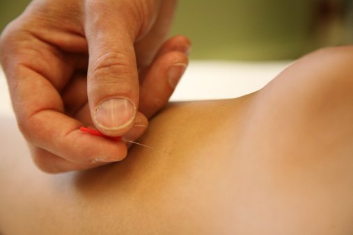 Homeopath23Dr's tweet photo. Could natural methods help kick opioid addiction to the curb? | https://t.co/rp1gqYqIlv https://t.co/UWO09wFRcZ #addiction #alternative_medicine https://t.co/Ub0sBXcGwU