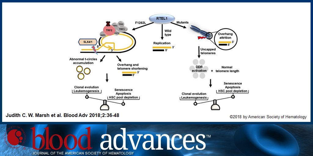 BloodAdvances's tweet photo. Heterozygous RTEL1 variants in bone marrow failure and myeloid neoplasms https://t.co/obI6narAtb https://t.co/2sLDw413nu