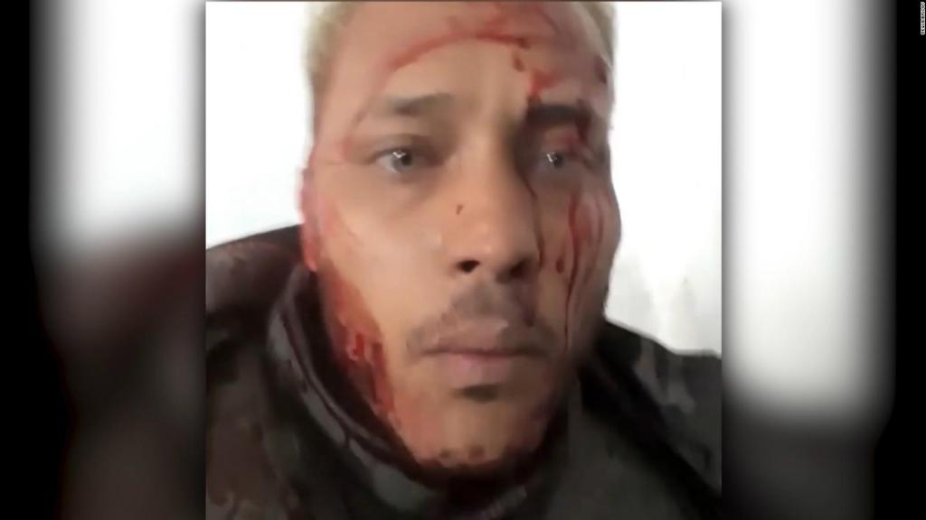CNNEE's tweet photo. Acta de defunción de Óscar Pérez revela que recibió un disparo en la cabeza #Venezuela https://t.co/ajDUBHHWTD https://t.co/pMwmyJgTE6