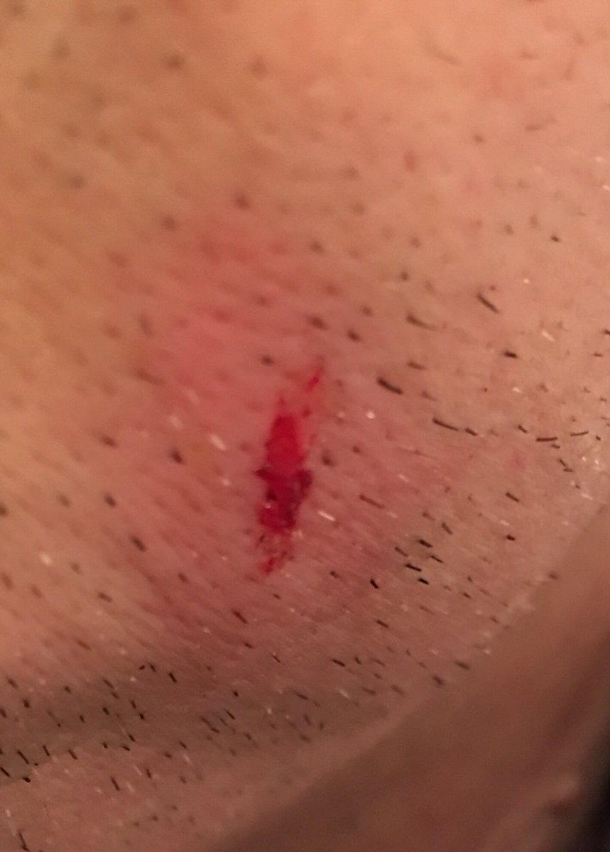 PD31's tweet photo. Cheers luv.....at least the brakes on my bike worked...not sure what happened to yours. Or your ability to steer. #bleedingtodeath https://t.co/5eTwgj78Dj