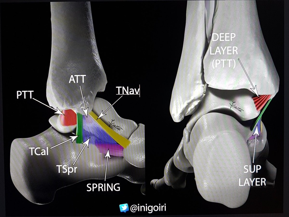 inigoiri's tweet photo. In two weeks we will start the Anatomy of the Ankle. Let me show you the Deltoid Ligament, a complex but fascinating structure. @Panamericanaesp online msk-#ultrasound course https://t.co/UyYyYGrDXW