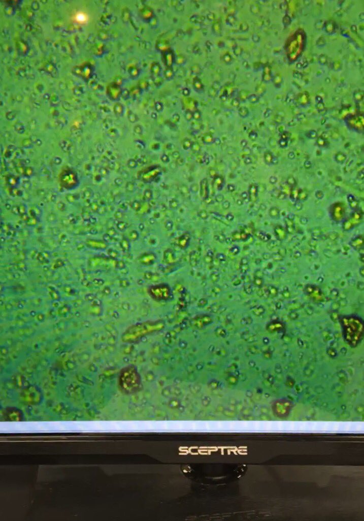 primordialsolut's tweet photo. Sea Green under the microscope at this year's Emerald Cup. Talk about biodiversity!
#primordialsolutions #seagreen #truebloom #rootamentary #paleobloom #marijuana #nugporn #terps #weedstagram #cannabisculture #cannabiscommunity #cannabislife #loyaltothesoil https://t.co/gCbCXh0EKR