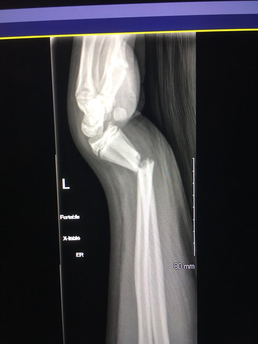StoutATC's tweet photo. @injurypics wrestling #welltheresyourproblem https://t.co/tE04SkCKD1