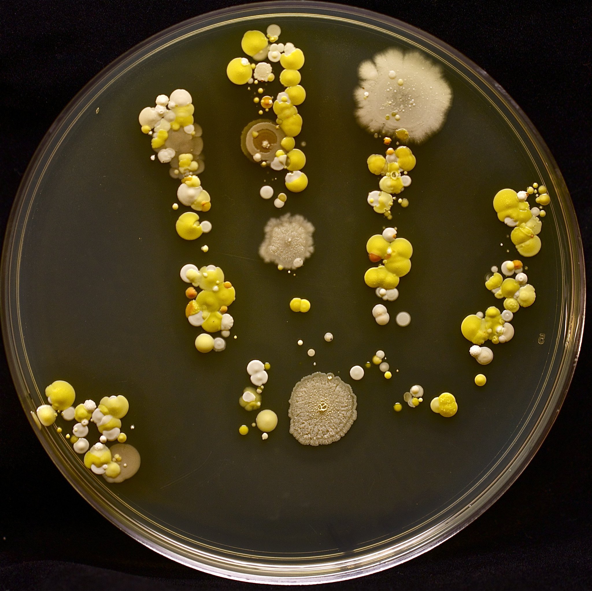 Tasha Sturm on Twitter: "Some have asked how I get the bacterial hand