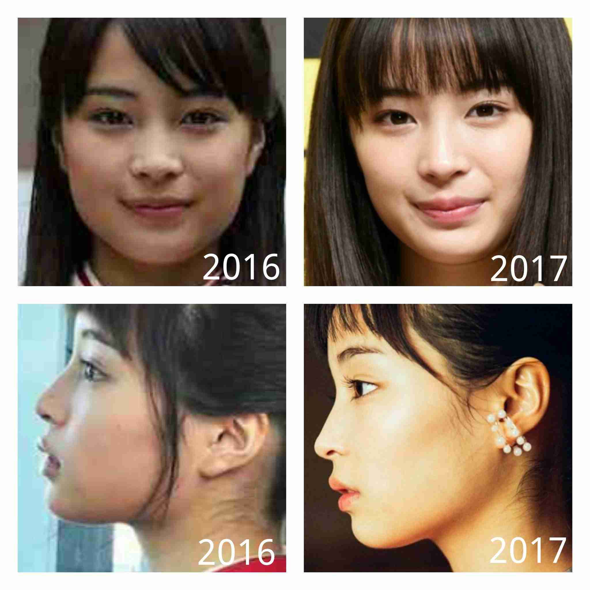 ガールズちゃんねる公式 整形疑惑があるけど 個人的には整形してないと思う芸能人 T Co Zanwpvbwmw T Co 3iwtcwnejl Twitter