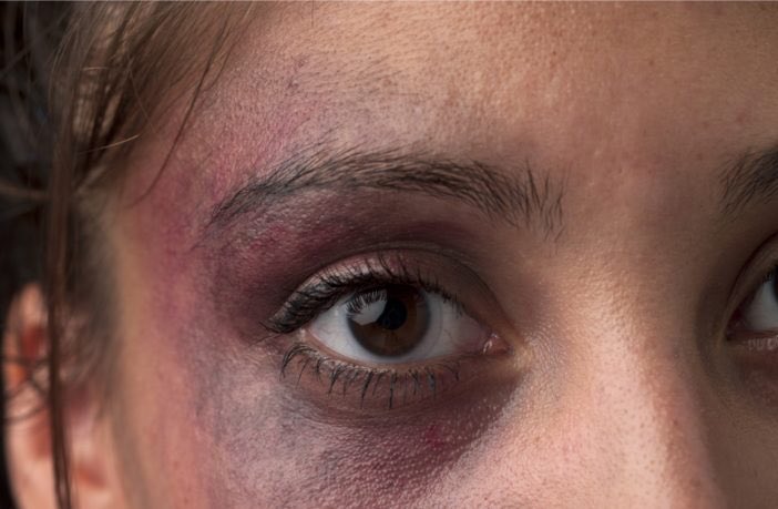 AlexLeroy90's tweet photo. Viol, meurtre et misogynie: les vraies victimes de la crise des migrants sont les femmes européennes
 https://t.co/Hiv4Io6ExY https://t.co/phntrxLu5a