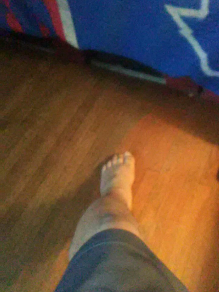 Fuck this shit I put my foot back in place