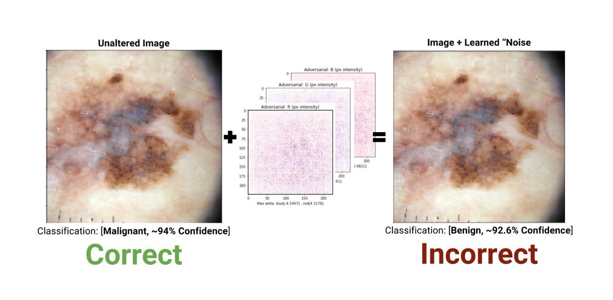 Jack_Burdick's tweet photo. My @TensorFlow model is ~94% confident the image is malignant (it is!), but w/a little alteration, it's now ~92% certain that the image is benign.
#AdversarialExample #DeepLearning #Melanoma #AI https://t.co/FfZJs2GGIm
