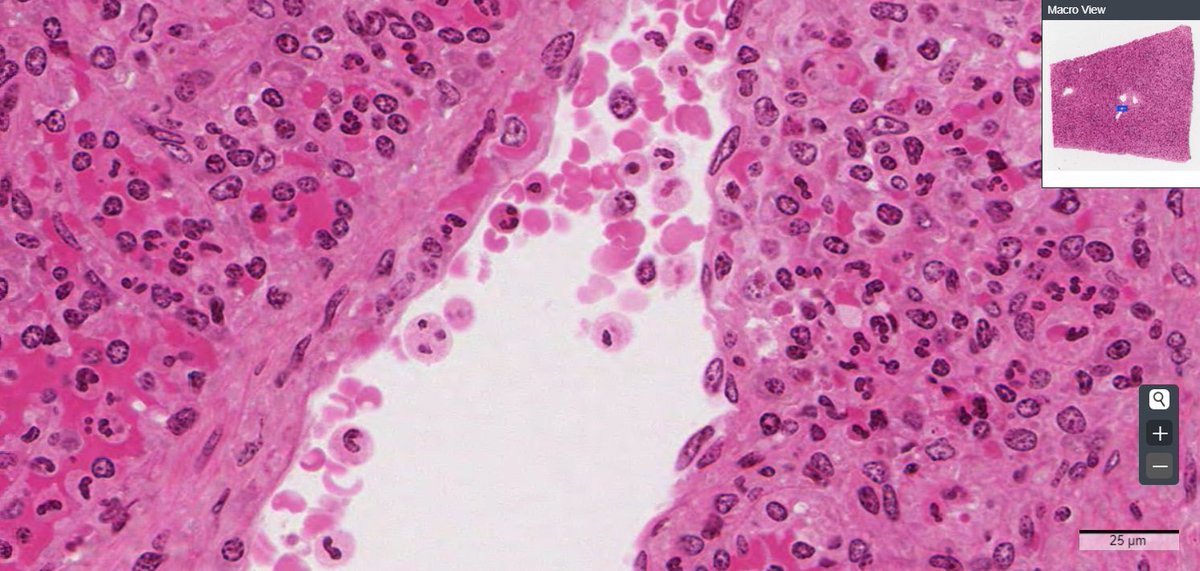 amandameyerphd's tweet image. I've been staring at #histology #micrographs too long today, they're starting to stare back!! :O #spleen #resinsection @Chapman_Histo @VMDatabase