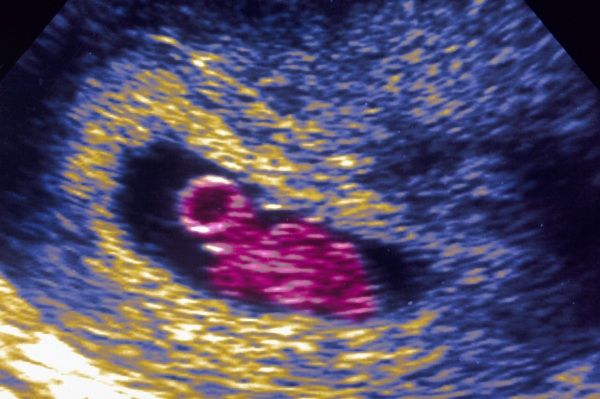 BiotechSol's tweet image. Gravidanza, sacco vitellino: cos'è e a cosa serve buff.ly/2DA9uLZ